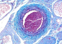 image of an artery, elastin fibers are the curly purple lines interior and exterior to the wall