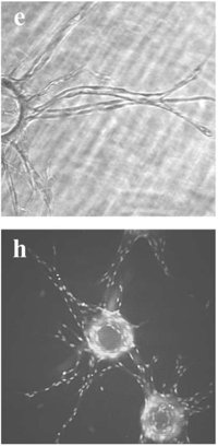 angiogenesis assay in fibrin gel